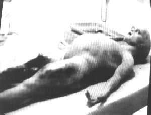 Foto dell'autopsia dell'alieno